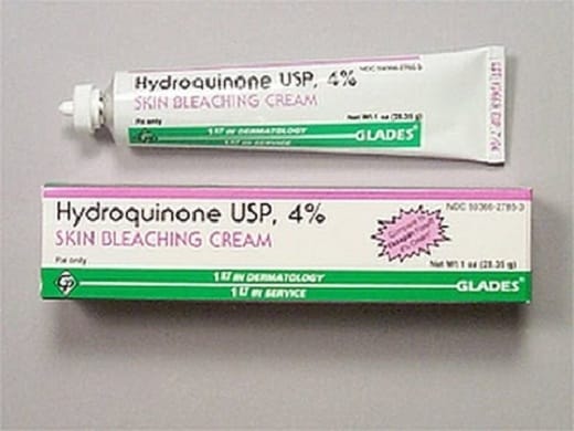 trị nám da với kem hydroquinone